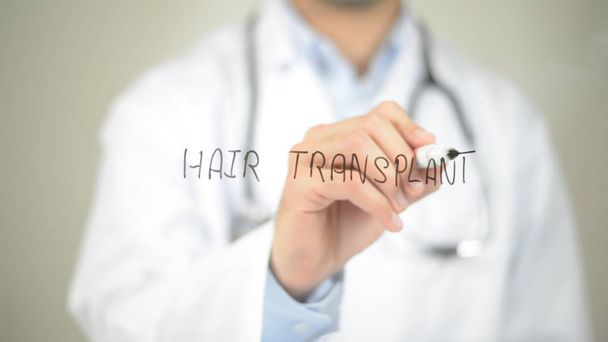 denver hair transplants